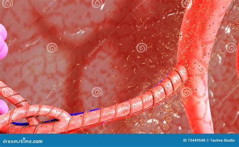 Lungs Granuloma stock photo. Image of lungs, granuloma - 73449548