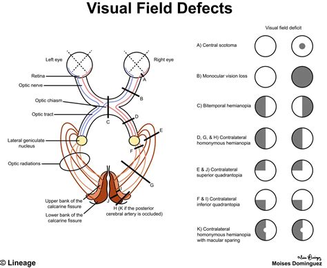 Visual Pathway - Neurology - Medbullets Step 1