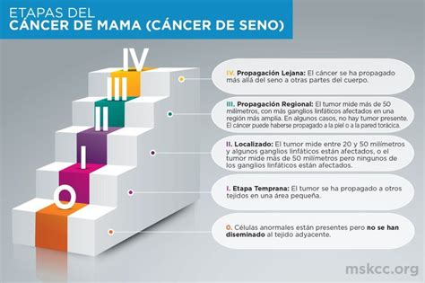 Estadios 0, 1, 2, 3 y 4 del cáncer de mama | Memorial Sloan Kettering Cancer Center