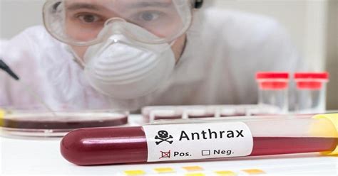 Global Anthrax Treatment Market 2019 - Product Awareness, Market ...