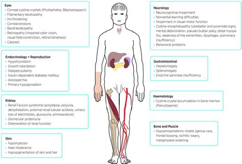 Frontiers | Nephropathic Cystinosis: Symptoms, Treatment, and Perspectives of a Systemic Disease ...