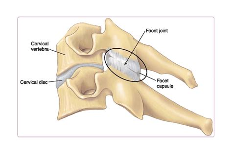 Cervical Facet Joint Anatomy | Hot Sex Picture