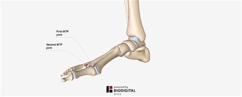 MTP Joint: Toe and Foot Pain