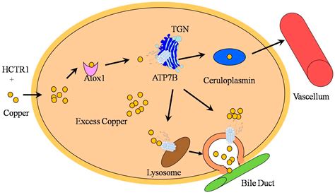 IJMS | Free Full-Text | Wilson’s Disease: A Comprehensive Review of the ...