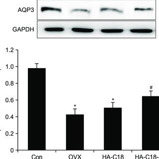 Immunoblotting results of aquaporin 3 (AQP3) in vaginal tissue from... | Download Scientific Diagram