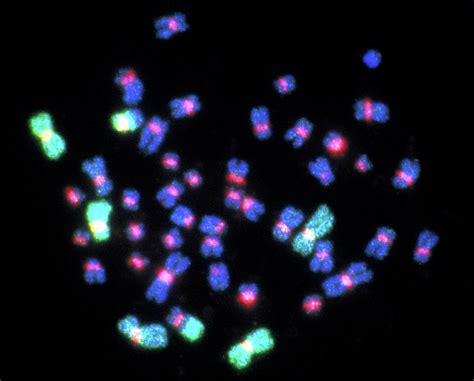 Fish Micrograph Of Abnormal Chromosomes Photograph by Public Health ...