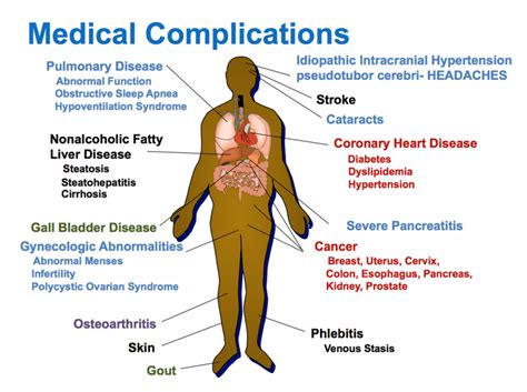 Bariatric Surgery (Morbid Obesity) Overview - Dr Anastasios