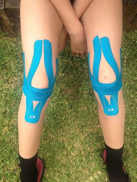 Kinesiology Tape | KT Tape | Kt tape knee, Kinesiology taping, Knee exercises