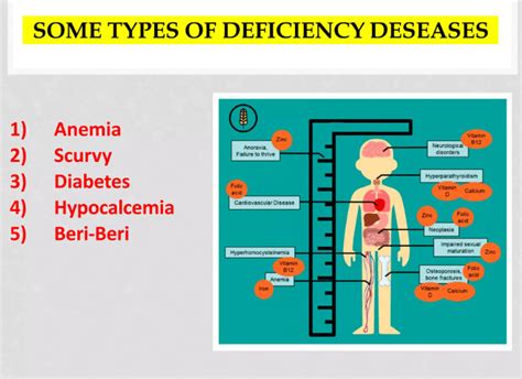 Vitamins and Minerals Deficiency Diseases