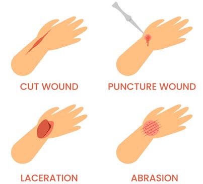 Cut Laceration