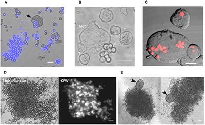 Frontiers | Cellular Events of Multinucleated Giant Cells Formation During the Encystation of ...