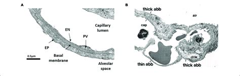 | Morphology of the air-blood barrier (ABB). (A) Thin portion of ABB... | Download Scientific ...