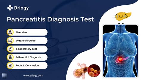 5 Essential Tests For Pancreatitis Diagnosis For Health - Drlogy