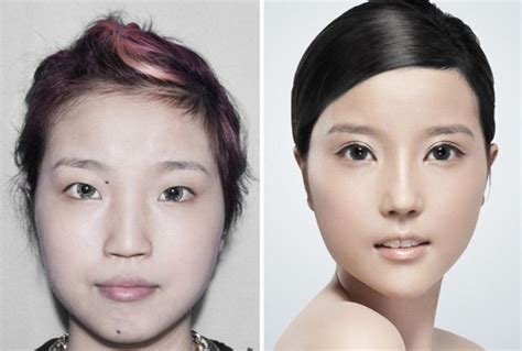 Plastic Surgery Is Popular In Asia (19 pics)