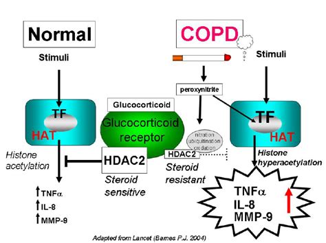 Proposed mechanism of glucocorticoid insensitivity in COPD patients. In... | Download Scientific ...