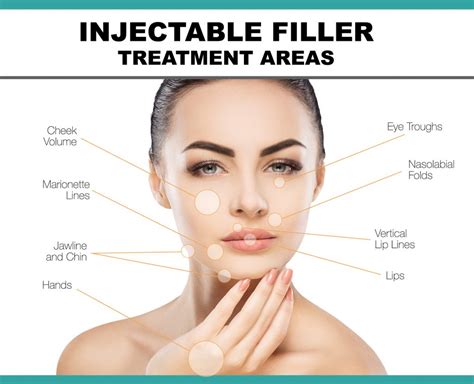 injectable-filler-treatment-areas - Slate Medspa