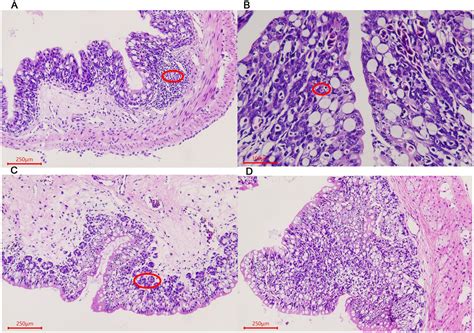 Frontiers | Changes of intestinal microbiota in the giant salamander ...