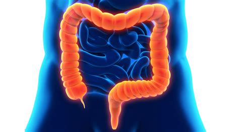 Inflammatory Bowel Disease (IBD) — Dr. Mona Dave, Pediatric ...