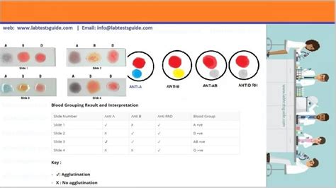 Blood Group Test Procedure, Interpretation, Result and more | Lab Tests ...