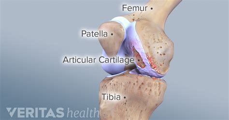 Knee cartilage repair, regeneration, and replacement are each used to ...