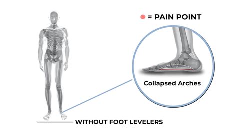 Foot Levelers in Middletown, OH | Chiropractic & Sports Medicine ...