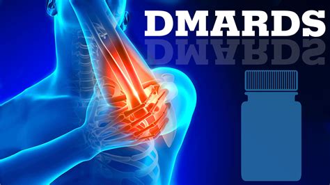 RA Treatment Options: DMARDS Video | thirdAGE