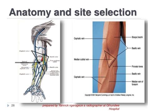 Common Venipuncture Sites With Diagram