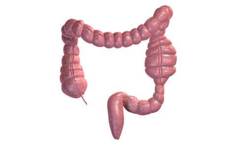 Complications of Crohn's disease | IBDrelief