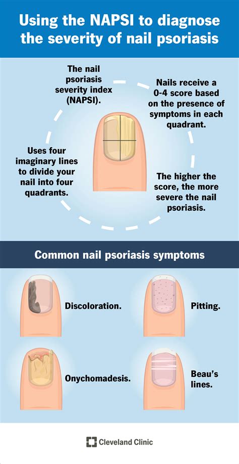 Details 149+ yellow nail syndrome vitamin e best - noithatsi.vn