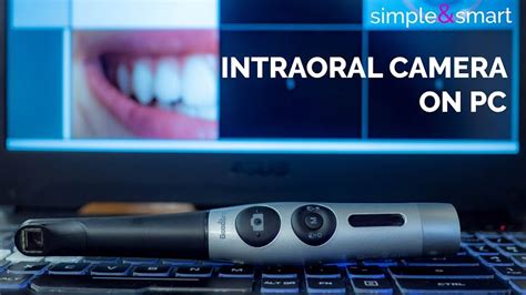 INTRAORAL CAMERA | SOFTWARE | INSTALLATION ON PC - YouTube