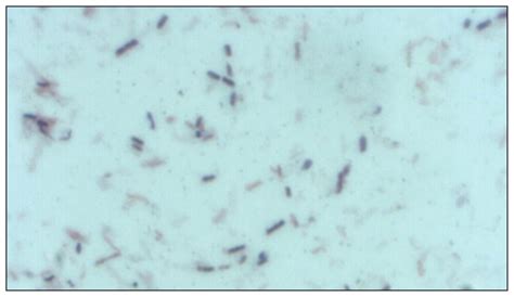 Clostridium septicum - Alchetron, The Free Social Encyclopedia