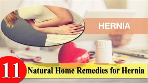 11 Natural Home Remedies for Hernia - YouTube