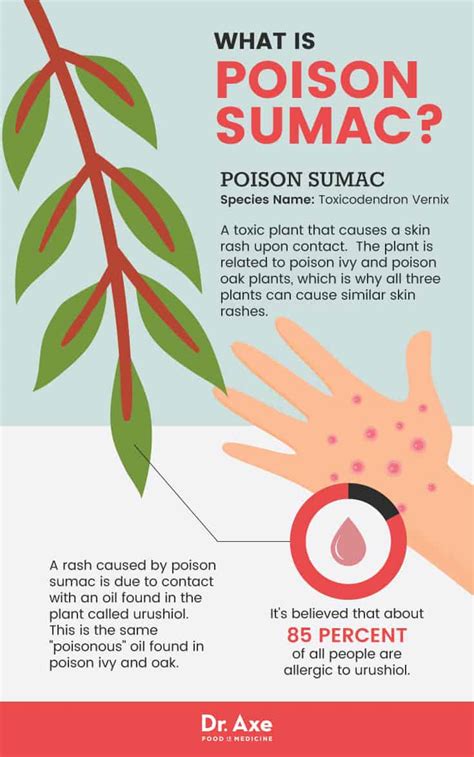 Poison Sumac Symptoms + 5 Natural Treatments - Dr. Axe