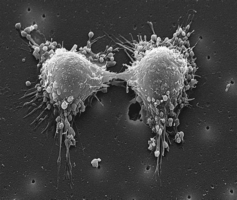 Cancer Cell Division Photograph by Steve Gschmeissner/science Photo Library - Pixels