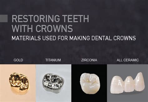 Crowns: Common Materials Used for Making Dental Crowns