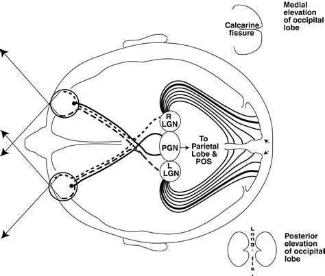 Macular sparing versus foveola sparing