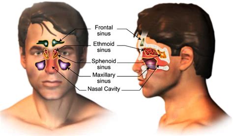 Maxillary Sinus Cancer