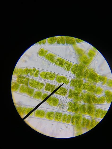 Spirogyra Under Microscope 400x Labeled