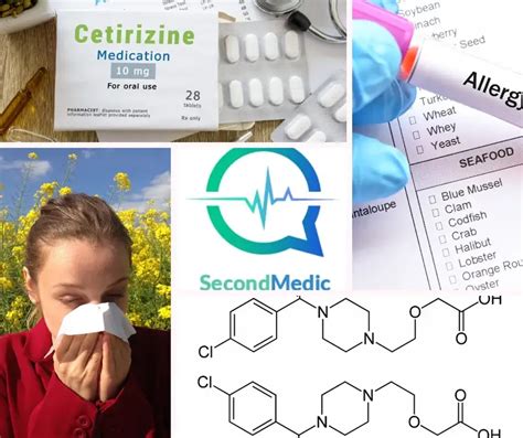 Cetirizine: Uses, Side Effects, and Precautions -Secondmedic