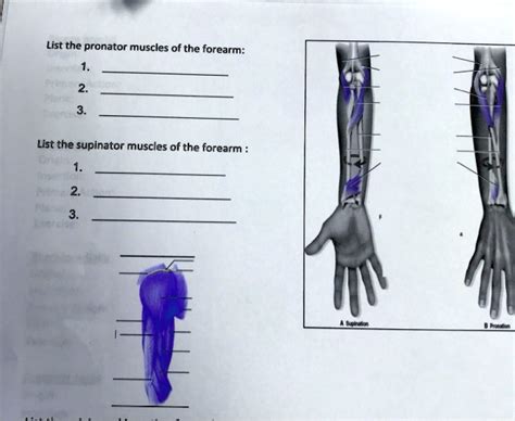 SOLVED: List the pronator muscles of the forearm: 1. Pronator teres 2 ...