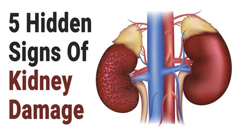 5 Hidden Signs of Kidney Damage