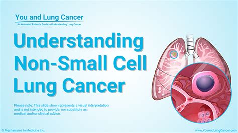 Animation - Understanding Non-Small Cell Lung Cancer