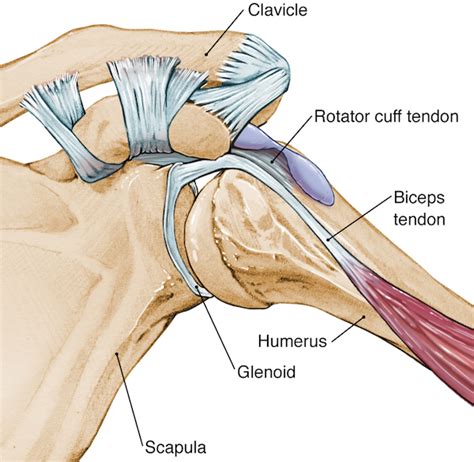 Long biceps tendonitis