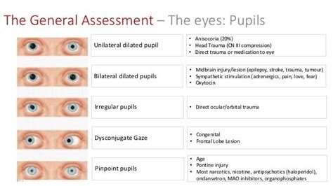 The Paramedic Neurological Assessment | Neurological assessment ...