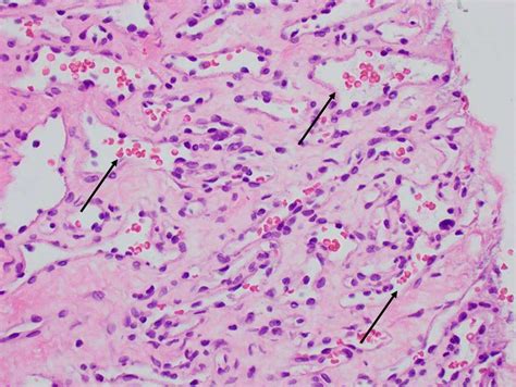 Capillary Histology