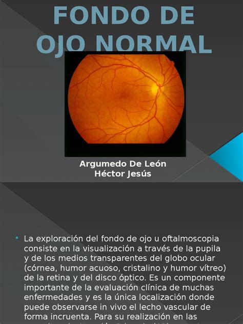 Reporte de Fondo de Ojo | Human Eye | Facial Features