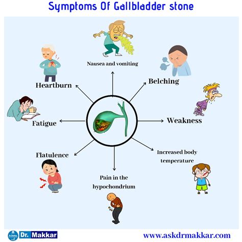 Gallstones cholelithesis Homeopathic Treatment Gall bladder stone ...