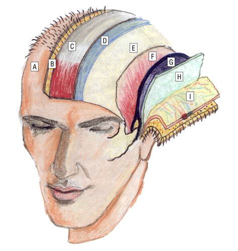 Hair-Bearing Temporoparietal Fascial Flap Reconstruction of Upper Lip and Scalp Defects ...