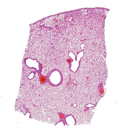 Lung Histology Labeled