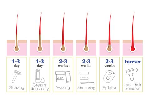 Laser Versus IPL - Bienvenue